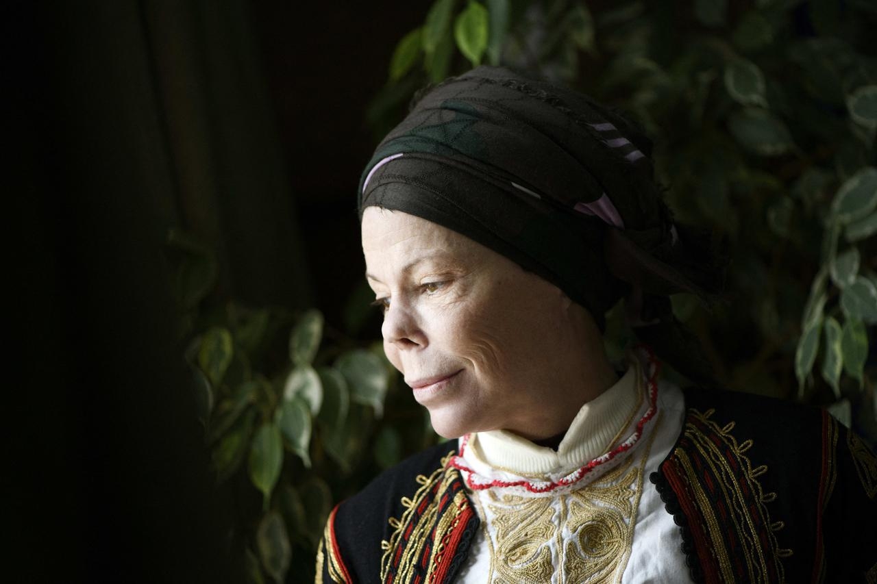 Iza lica princeze Kaline krije se borba za život: Teška infekcija zauvijek joj je promijenila lice