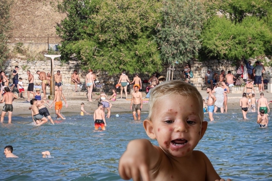 UPOZORENJE RODITELJIMA: Impetigo se širi među djecom u Splitu, ovo su prvi simptomi