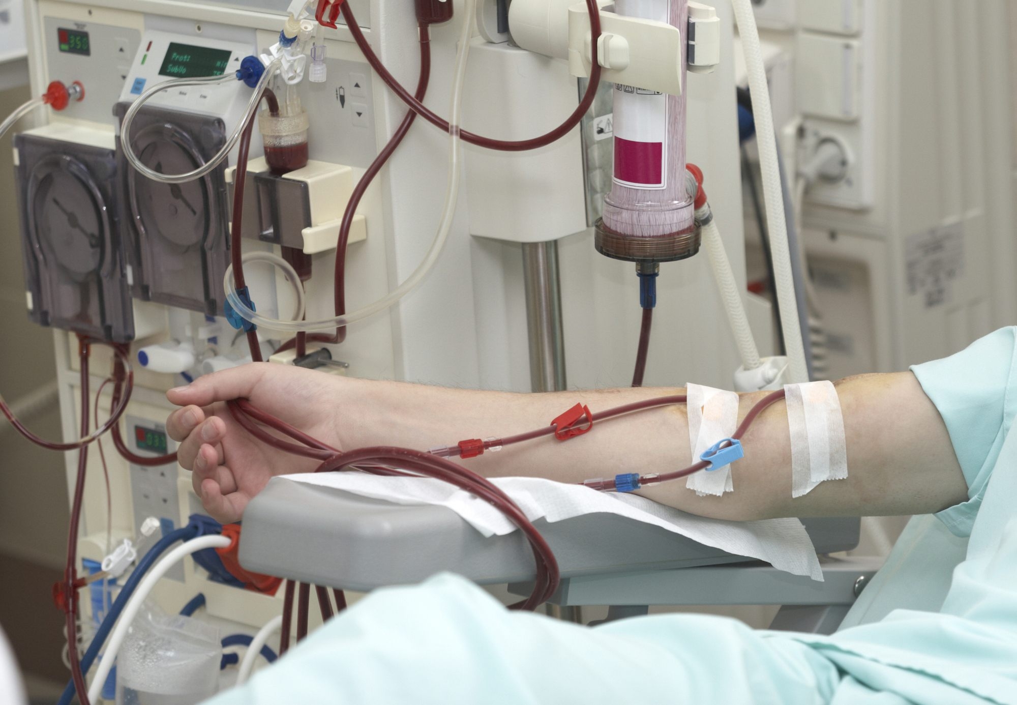 Protesti sve izvjesniji: Aparati za dijalizu u FBiH stari, pacijenti nabavljaju lijekove, a transplantacija ni na vidiku