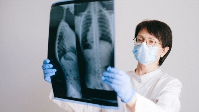 Prvi znakovi opasne plućne bolesti