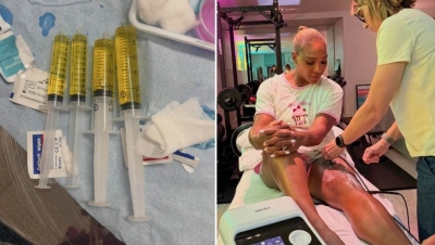 Serena Vilijams sa Vimbldona objavila uznemirujuće fotografije: “Ovo su mi ljekari izvukli iz koljena”