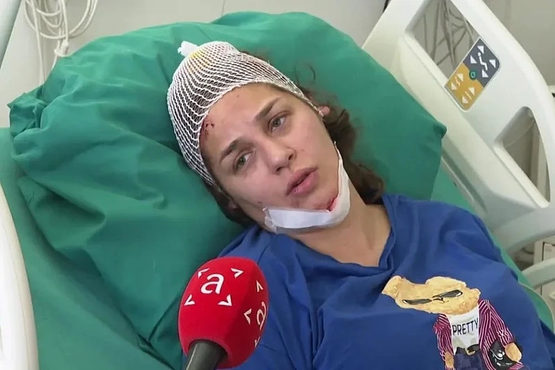 Anja Ljubojević se javila iz bolnice nakon nesreće: "Bila sam na fešti, popila sam par pića"