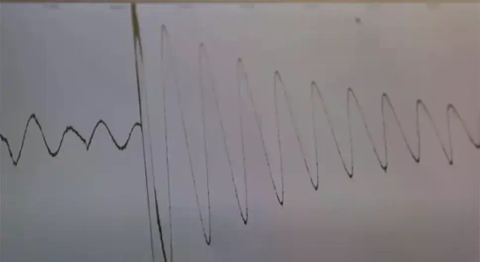 Земљотрес у Србији: Ево гдје се затресло тло