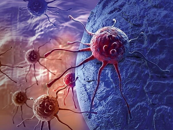 Sve više mladih obolijeva od ovih 11 vrsta raka