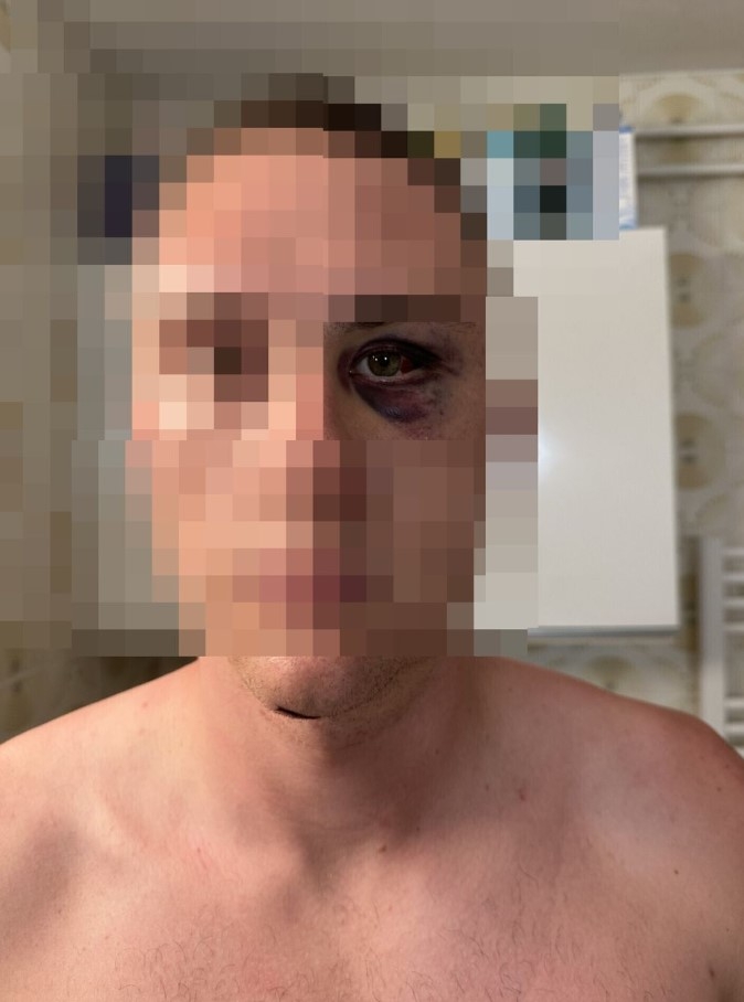 Iz čista mira: U Hrvatskoj brutalno pretučeni Slovenci