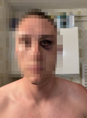 Iz čista mira: U Hrvatskoj brutalno pretučeni Slovenci