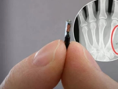 Hiljade Šveđana ugradilo mikročipove u šake