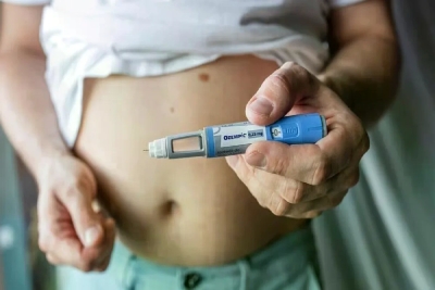 Od „Ozempic lica“ do opadanja kose: Šta je nauka, a šta pretjerivanje o lijekovima za mršavljenje