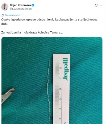 Banjalučki doktor objavio fotografiju: Iz kapka odstranjen crv od 6 cm, objasnio kako dolazi do ovakvih slučajeva