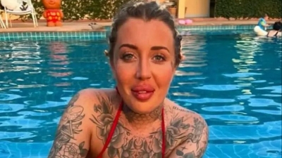 Influenserica pala s terase hotela: Slomila kičmu na 24 mjesta