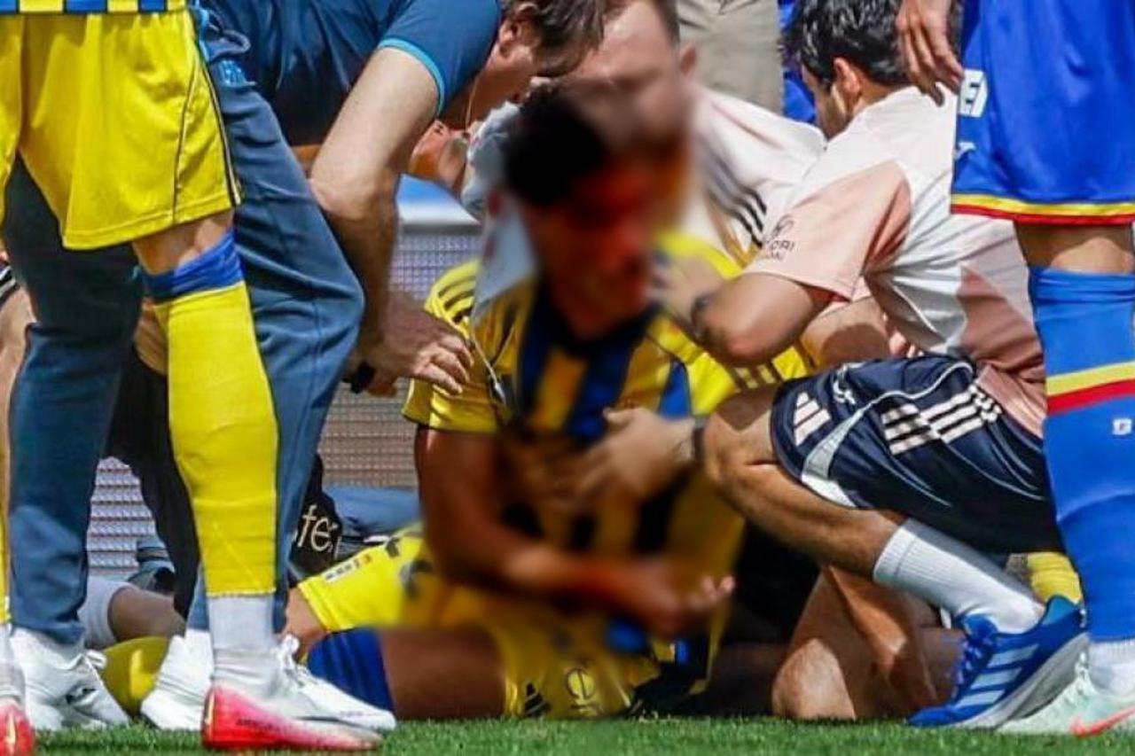 Užasne scene na utakmici, igrač nakon sudara u krvi morao napustiti teren...