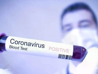 Tragovi korona virusa pronađeni u organima tri godine nakon epidemije