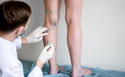 Začepljene arterije na nogama mogu ugroziti srce: Evo kako prepoznati simptome na vrijeme