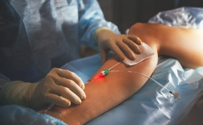 Laserska kirurgija u Poliklinici i dnevnoj bolnici Vitalis Mostar: Suvremeni zahvati, minimalna bol i brz oporavak