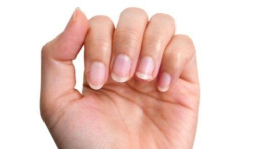 Psorijaza noktiju: Kako prepoznati simptome i ublažiti tegobe