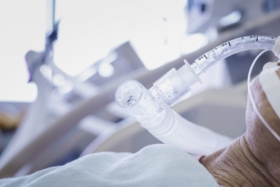 Oglasili se iz UKC-a: Vozač “BMW-a” životno ugrožen i priključen na respirator