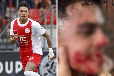 UZNEMIRUJUĆE Trener u Nizozemskoj nokautirao igrača, izbio mu sedam zuba