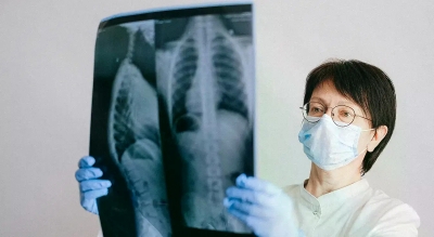 Због вејпа плућа "пуцају" као кокице: Љекари дијагностиковали нову болест